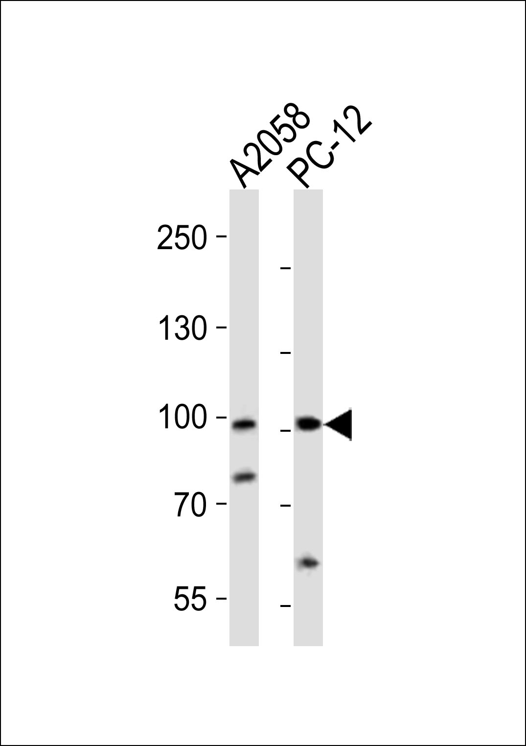 Western blot analysis of lysates from A2058, rat PC-12 cell line (from left to right),  using PROX1 Antibody (C-term)(Cat.  #AP2035b).  AP2035b was diluted at 1:1000 at each lane.  A goat anti-rabbit IgG H&L(HRP) at 1:10000 dilution was used as the secondary antibody. Lysates at 20ug per lane.