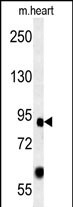 FOXP2 Antibody (C-term) (Cat. #AP5753b) western blot analysis in mouse heart tissue lysates (15ug/lane).This demonstrates the FOXP2 antibody detected FOXP2 protein (arrow).