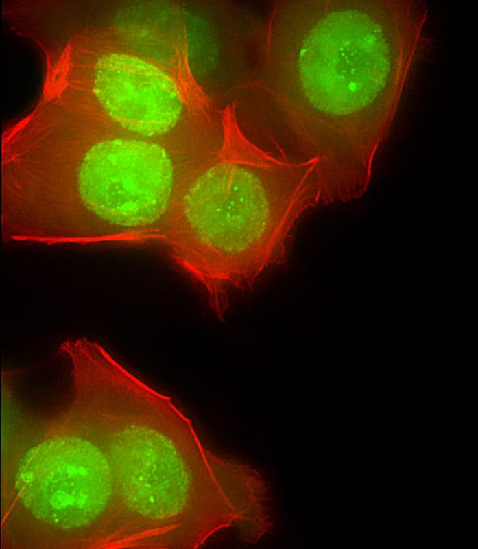 Immunofluorescent analysis of 4% paraformaldehyde-fixed, 0.1% Triton X-100 permeabilized MCF-7 (human breast cancer cell line) cells labeling CUX1 with AP5895b at 1/25 dilution, followed by Dylight® 488-conjugated goat anti-rabbit IgG (NK179883) secondary antibody at 1/200 dilution (green). Immunofluorescence image showing nucleus and weak cytoplasm staining on MCF-7 cell line. Cytoplasmic actin is detected with Dylight® 554 Phalloidin (PD18466410) at 1/100 dilution (red).