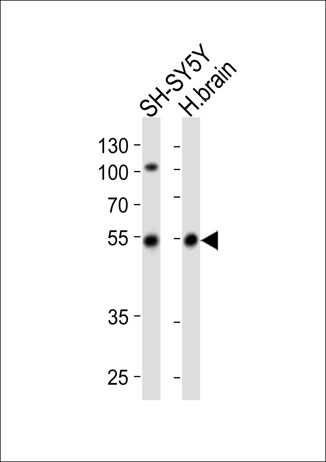Western blot analysis of lysates from SH-SY5Y cell line, human brain tissue lysate (from left to right),  using Park2 Antibody (N-term)(Cat.  #TA324838).  TA324838 was diluted at 1:1000 at each lane.  A goat anti-rabbit IgG H&L(HRP) at 1:10000 dilution was used as the secondary antibody. Lysates at 20ug per lane.