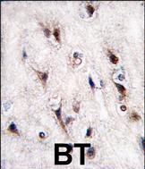 Formalin-fixed and paraffin-embedded human brain tissue reacted with NURR1 (NR4A2) antibody (N-term)(Cat#TA324841), which was peroxidase-conjugated to the secondary antibody, followed by DAB staining. This data demonstrates the use of this antibody for immunohistochemistry; clinical relevance has not been evaluated.