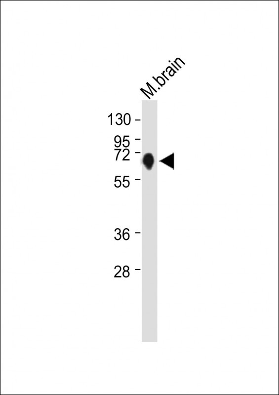Anti-NURR1 (NR4A2) Antibody (N-term) at 1:1000 dilution + Mouse brain whole tissue lysate

Lysates/proteins at 20 µg per lane. 

Secondary
Goat Anti-Rabbit IgG,  (H+L), Peroxidase conjugated at 1/10000 dilution. 

Predicted band size : 67 kDa

Blocking/Dilution buffer: 5% NFDM/TBST.