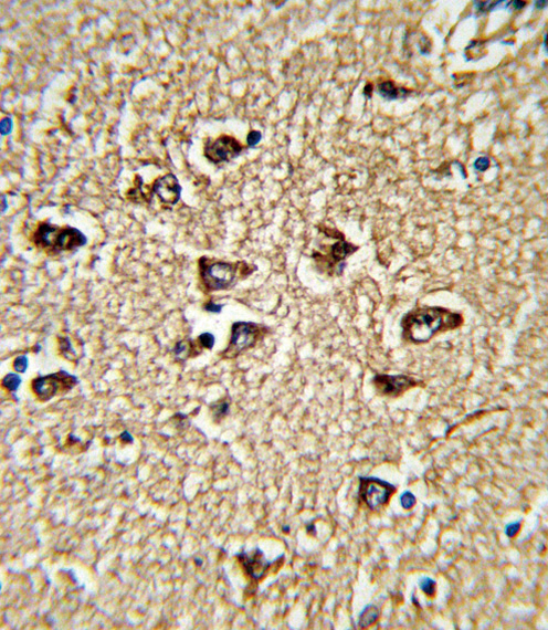 Formalin-fixed and paraffin-embedded human brain tissue reacted with BICC1 Antibody (N-term), which was peroxidase-conjugated to the secondary antibody, followed by DAB staining. This data demonstrates the use of this antibody for immunohistochemistry; clinical relevance has not been evaluated.