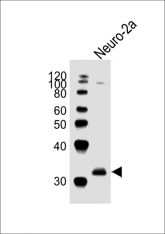Anti-EN2Antibody(C-term)at  1:1000 dilution + Neuro-2a whole cell lysates

Lysates/proteins at 20 µg per lane. 

Secondary
Goat Anti-Rabbit IgG,  (H+L), Peroxidase conjugated at 1/10000 dilution

Predicted band size : 34 kDa

Blocking/Dilution buffer: 5% NFDM/TBST.