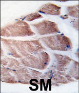Formalin-fixed and paraffin-embedded human skeletal muscle tissue reacted with RSK3 antibody (N-term) (Cat.#TA325008), which was peroxidase-conjugated to the secondary antibody, followed by DAB staining. This data demonstrates the use of this antibody for immunohistochemistry; clinical relevance has not been evaluated.