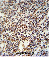 USF2 Antibody (Center) (Cat. #TA325049) immunohistochemistry analysis in formalin fixed and paraffin embedded human lymph tissue followed by peroxidase conjugation of the secondary antibody and DAB staining.  This data demonstrates the use of the USF2 Antibody (Center) for immunohistochemistry.  Clinical relevance has not been evaluated.