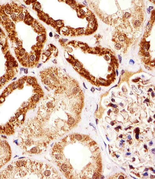 Immunohistochemical analysis of paraffin-embedded H. kideny section using SSNA1 Antibody (N-term)(Cat#AP20483A). AP20483A was diluted at 1:25 dilution. A undiluted biotinylated goat polyvalent antibody was used as the secondary, followed by DAB staining.