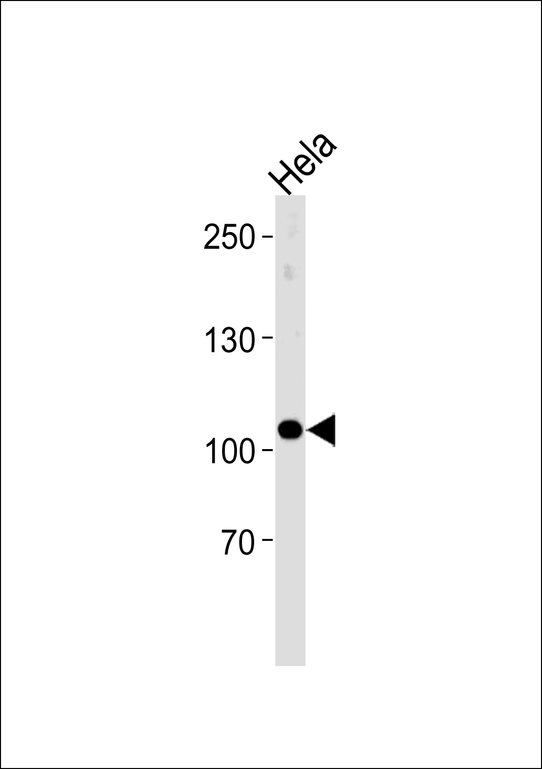UBE3C Antibody (Center) (Cat. #TA325160) western blot analysis in Hela cell line lysates (35ug/lane).This demonstrates the UBE3C antibody detected the UBE3C protein (arrow).