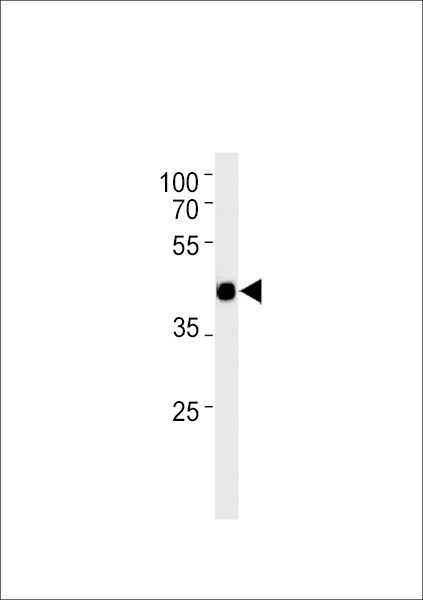 Mouse Tcfap2d Antibody (C-term) (Cat. #TA325179) western blot analysis in mouse heart tissue lysates (35ug/lane).This demonstrates the Mouse Tcfap2d antibody detected the Mouse Tcfap2d protein (arrow).