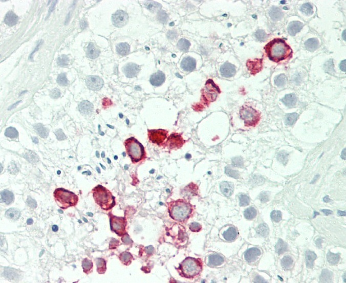 Formalin-fixed and paraffin-embedded H.testis tissue reacted with IFNA4 Antibody (C-term) (Cat#TA325190).