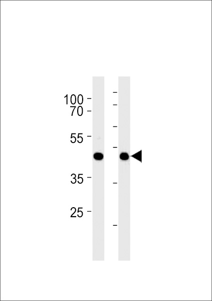 Mouse Gpr68 Antibody (Center) (Cat. #TA328194) western blot analysis in mouse liver and heart tissue lysates (35ug/lane).This demonstrates the Mouse Gpr68 antibody detected the Mouse Gpr68 protein (arrow).