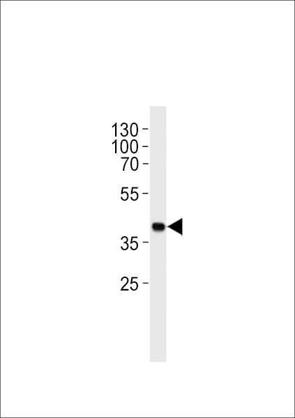Mouse Sh2d5 Antibody (Center) (Cat. #TA328195) western blot analysis in mouse heart tissue lysates (35ug/lane).This demonstrates the mouse Sh2d5 antibody detected the mouse Sh2d5 protein (arrow).