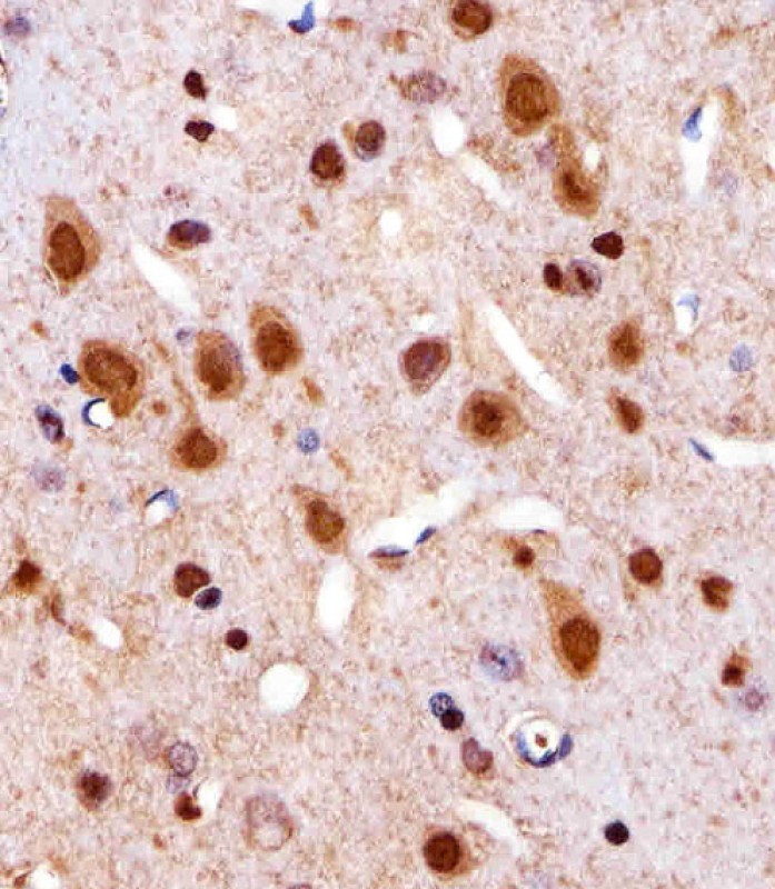 Immunohistochemical analysis of paraffin-embedded R. brain section using R Cdk4 Antibody (C-term)(Cat#AP20515B). AP20515B was diluted at 1:25 dilution. A undiluted biotinylated goat polyvalent antibody was used as the secondary, followed by DAB staining.