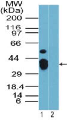 Western Blot: Rhox9 Antibody TA336963 - analysis of Rhox-9 in mouse placenta in the 1) absence and 2) presence of immunizing peptide using this antibody. I goat anti-rabbit Ig HRP secondary antibody and PicoTect ECL substrate solution were used for this test.