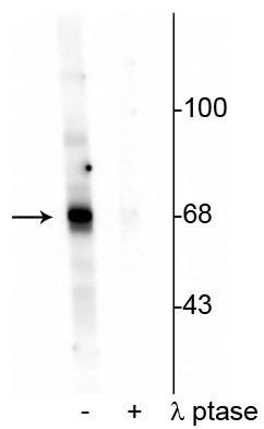Phospho-AKT1 (pThr342) Rabbit Polyclonal Antibody
