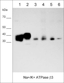 Western blot of native human MDA-MB-231 (lane 1), and MeWo (lane 2) cell lysates, as well as native human breast (lane 3), lung (lane 4), skin (lane 5), and brain (lane 6) tissues. The blot was probed with anti-Na+/K+ ATPase β3 at 1:1000.