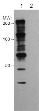 Western blot of human A431 cells treated with Calyculin A (100 nM) for 30 min. The blot was untreated (lane 1) or treated with lambda phosphatase (lanes 2), then probed with anti-Phosphothreonine at 1:1000.