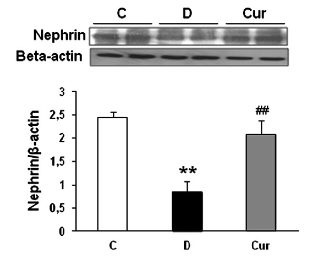 Nephrin Rabbit Nephrin (NPHS1) Rabbit Polyclonal Antibody | TA306037 | OriGene ...