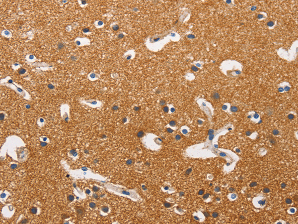 Immunohistochemistry of paraffin-embedded Human brain tissue using TA364650 (HK1/HK2 Antibody) at dilution 1/40 (Original magnification: ×200)