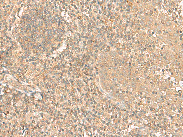 Immunohistochemistry of paraffin-embedded Human tonsil tissue using TA368504 (HLA-A/F/H Antibody) at dilution 1/20 (Original magnification: ×200)