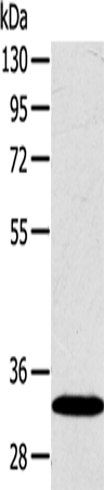 Gel: 8%SDS-PAGE<br>Lysate: 40 μg<br>Lane: Human fetal liver tissue<br>Primary antibody: TA369378 (SULT2A1 Antibody) at dilution 1/650<br>Secondary antibody: Goat anti rabbit IgG at 1/8000 dilution<br>Exposure time: 1 second