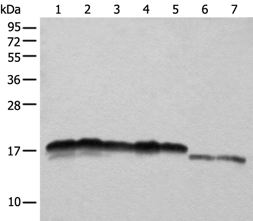 Gel: 12%SDS-PAGE<br>Lysate: 40 μg<br>Lane 1-7: Hela<br>HEPG2<br>A431<br>K562 and 231 cell<br>Mouse liver tissue and Mouse brain tissue lysates<br>Primary antibody: TA369505 (NDUFB11 Antibody) at dilution 1/1000<br>Secondary antibody: Goat anti rabbit IgG at 1/8000 dilution<br>Exposure time: 10 seconds