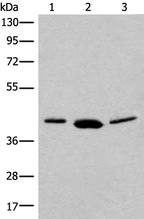 Gel: 8%SDS-PAGE<br>Lysate: 40 μg<br>Lane 1-3: PC-3 cell<br>Human bladder transitional cell carcinoma grade 2-3 tissue<br>231 cell lysates<br>Primary antibody: TA372457 (MRI1 Antibody) at dilution 1/250<br>Secondary antibody: Goat anti rabbit IgG at 1/8000 dilution<br>Exposure time: 1 minute