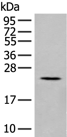 Gel: 12%SDS-PAGE<br>Lysate: 40 μg<br>Lane: Rat pancreas tissue lysate<br>Primary antibody: TA372498 (IL17B Antibody) at dilution 1/200<br>Secondary antibody: Goat anti rabbit IgG at 1/8000 dilution<br>Exposure time: 3 minutes