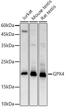 Glutathione Peroxidase 4 (GPX4) Rabbit Polyclonal Antibody | TA327216 | OriGene Technologies Inc. Glutathione Peroxidase 4 (GPX4) Rabbit Polyclonal Antibody | TA327216 | OriGene Technologies Inc.