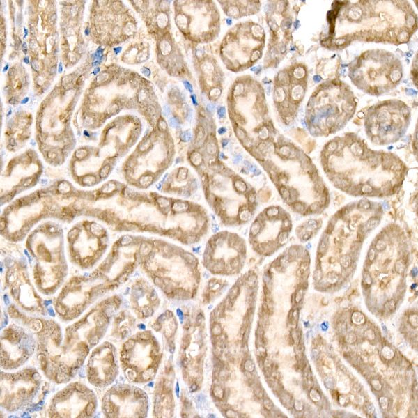 Glutathione Peroxidase 4 (GPX4) Rabbit Polyclonal Antibody | TA327216 | OriGene Technologies Inc. Glutathione Peroxidase 4 (GPX4) Rabbit Polyclonal Antibody | TA327216 | OriGene Technologies Inc.