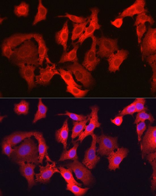 glutathione 3 peroxidase antibody Human / GPX-3 AssayLite (APC Conjugate) Anti-Glutathione Peroxidase 4 Antibody, clone