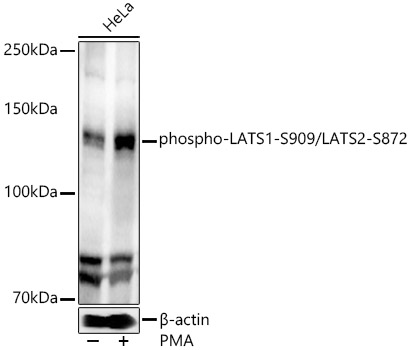 Phospho LATS1 (Ser909) LATS2 (Ser872) Rabbit Polyclonal Antibody