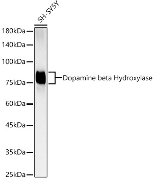 Western blot analysis of lysates from SH-SY5Y cells, using Dopamine beta Hydroxylase Rabbit mAb (TA425715) at 1:1000 dilution.<br/>Secondary antibody: HRP-conjugated Goat anti-Rabbit IgG (H+L) at 1:10000 dilution.<br/>Lysates/proteins: 25μg per lane.<br/>Blocking buffer: 3% nonfat dry milk in TBST.<br/>Detection: ECL Basic Kit .<br/>Exposure time: 180s.