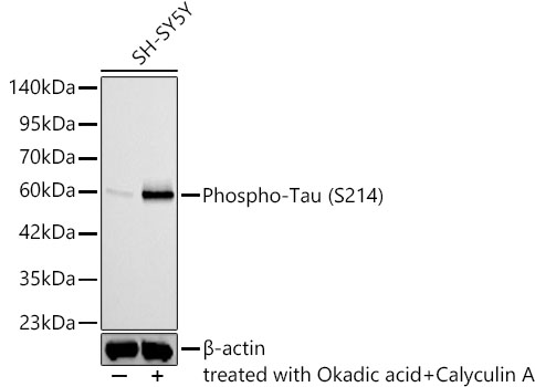 Western blot analysis lysates from SH-SY5Y, using Phospho-Tau (S214) Rabbit mAb (TA425716) at 1:1000 dilution. SH-SY5Y cells were treated by Okadaic Acid (100 nM) at 37℃ for 1 hour and Calyculin A (100nM) at 37℃ for 30 minutes after serum-starvation overnight.℃ for 30 minutes after serum-starvation overnight.<br/>Secondary antibody: HRP-conjugated Goat anti-Rabbit IgG (H+L) at 1:10000 dilution.<br/>Lysates/proteins: 25ug per lane.<br/>Blocking buffer: 3% nonfat dry milk in TBST.<br/>Detection: ECL Basic Kit .<br/>Exposure time: 60s.