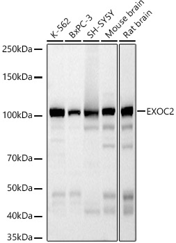 Western blot analysis of various lysates, using EXOC2 Rabbit mAb (TA425726) at 1:400 dilution.<br/>Secondary antibody: HRP-conjugated Goat anti-Rabbit IgG (H+L) at 1:10000 dilution.<br/>Lysates/proteins: 25μg per lane.<br/>Blocking buffer: 3% nonfat dry milk in TBST.<br/>Detection: ECL Basic Kit .<br/>Exposure time: 30s.