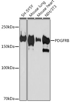 Western blot analysis of various lysates using PDGFRB Rabbit mAb (TA425740) at 1:1000 dilution.<br/>Secondary antibody: HRP-conjugated Goat anti-Rabbit IgG (H+L) at 1:10000 dilution.<br/>Lysates/proteins: 25μg per lane.<br/>Blocking buffer: 3% nonfat dry milk in TBST.<br/>Detection: ECL Basic Kit .<br/>Exposure time: 90s.