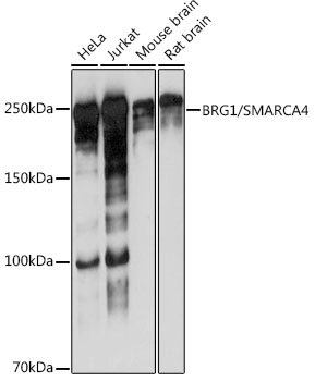 Western blot analysis of lysates from HeLa cells using BRG1/SMARCA4 Rabbit mAb (TA425755) at 1:1000 dilution incubated overnight at 4℃.<br/>Secondary antibody: HRP-conjugated Goat anti-Rabbit IgG (H+L) at 1:10000 dilution.<br/>Lysates/proteins: 25 μg per lane.<br/>Blocking buffer: 3% nonfat dry milk in TBST.<br/>Detection: ECL Basic Kit .<br/>Exposure time: 10s.