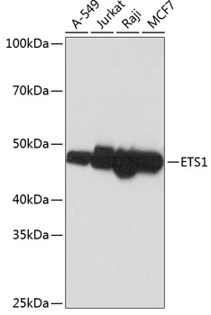 Western blot analysis of various lysates using ETS1 Rabbit mAb (TA425773) at 1:1000 dilution.<br/>Secondary antibody: HRP-conjugated Goat anti-Rabbit IgG (H+L) at 1:10000 dilution.<br/>Lysates/proteins: 25μg per lane.<br/>Blocking buffer: 3% nonfat dry milk in TBST.<br/>Detection: ECL Basic Kit .<br/>Exposure time: 1min.