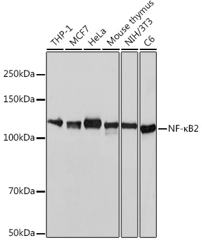 Western blot analysis of various lysates using NF-κB2 Rabbit mAb (TA425775) at 1:1000 dilution.<br/>Secondary antibody: HRP-conjugated Goat anti-Rabbit IgG (H+L) at 1:10000 dilution.<br/>Lysates/proteins: 25μg per lane.<br/>Blocking buffer: 3% nonfat dry milk in TBST.<br/>Detection: ECL Basic Kit .<br/>Exposure time: 3s.
