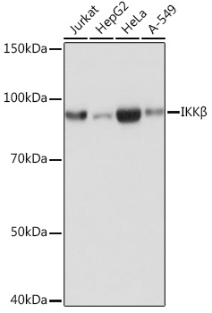 Western blot analysis of various lysates using IKKβ Rabbit mAb (TA425776) at 1:1000 dilution.<br/>Secondary antibody: HRP-conjugated Goat anti-Rabbit IgG (H+L) at 1:10000 dilution.<br/>Lysates/proteins: 25μg per lane.<br/>Blocking buffer: 3% nonfat dry milk in TBST.<br/>Detection: ECL Basic Kit .<br/>Exposure time: 1s.