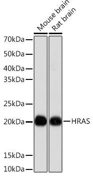 Western blot analysis of various lysates using HRAS Rabbit mAb (TA425780) at 1:1000 dilution.<br/>Secondary antibody: HRP-conjugated Goat anti-Rabbit IgG (H+L) at 1:10000 dilution.<br/>Lysates/proteins: 25μg per lane.<br/>Blocking buffer: 3% nonfat dry milk in TBST.<br/>Detection: ECL Basic Kit .<br/>Exposure time: 10s.