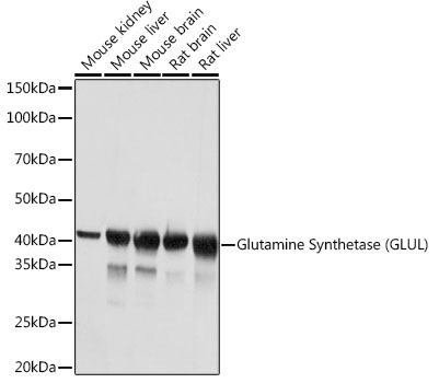 Western blot analysis of various lysates using Glutamine Synthetase (GLUL) Rabbit mAb (TA425791) at 1:1000 dilution.<br/>Secondary antibody: HRP-conjugated Goat anti-Rabbit IgG (H+L) at 1:10000 dilution.<br/>Lysates/proteins: 25μg per lane.<br/>Blocking buffer: 3% nonfat dry milk in TBST.<br/>Detection: ECL Basic Kit .<br/>Exposure time: 1s.
