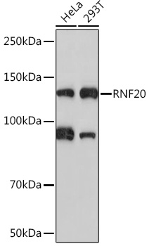 Western blot analysis of various lysates using RNF20 Rabbit mAb (TA425817) at 1:1000 dilution.<br/>Secondary antibody: HRP-conjugated Goat anti-Rabbit IgG (H+L) at 1:10000 dilution.<br/>Lysates/proteins: 25μg per lane.<br/>Blocking buffer: 3% nonfat dry milk in TBST.<br/>Detection: ECL Basic Kit .<br/>Exposure time: 90s.
