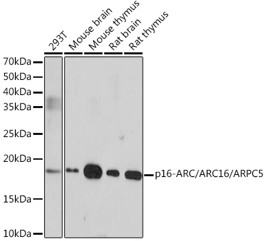 Western blot analysis of various lysates using p16-ARC/ARC16/ARPC5 Rabbit mAb (TA425820) at 1:1000 dilution.<br/>Secondary antibody: HRP-conjugated Goat anti-Rabbit IgG (H+L) at 1:10000 dilution.<br/>Lysates/proteins: 25μg per lane.<br/>Blocking buffer: 3% nonfat dry milk in TBST.<br/>Detection: ECL Enhanced Kit .<br/>Exposure time: 3min.