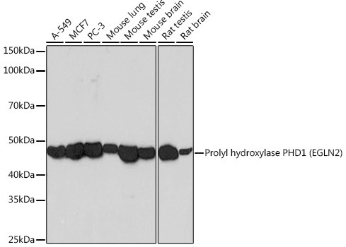 Western blot analysis of various lysates using Prolyl hydroxylase PHD1 (EGLN2) Rabbit mAb (TA425825) at 1:1000 dilution.<br/>Secondary antibody: HRP-conjugated Goat anti-Rabbit IgG (H+L) at 1:10000 dilution.<br/>Lysates/proteins: 25μg per lane.<br/>Blocking buffer: 3% nonfat dry milk in TBST.<br/>Detection: ECL Basic Kit .<br/>Exposure time: 3min.