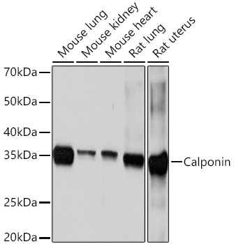 Western blot analysis of various lysates using Calponin Rabbit mAb (TA425827) at 1:1000 dilution.<br/>Secondary antibody: HRP-conjugated Goat anti-Rabbit IgG (H+L) at 1:10000 dilution.<br/>Lysates/proteins: 25μg per lane.<br/>Blocking buffer: 3% nonfat dry milk in TBST.<br/>Detection: ECL Basic Kit .<br/>Exposure time: 10s.