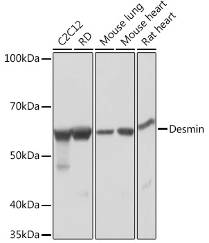 Western blot analysis of various lysates using Desmin Rabbit mAb (TA425830) at 1:1000 dilution.<br/>Secondary antibody: HRP-conjugated Goat anti-Rabbit IgG (H+L) at 1:10000 dilution.<br/>Lysates/proteins: 25μg per lane.<br/>Blocking buffer: 3% nonfat dry milk in TBST.<br/>Detection: ECL Basic Kit .<br/>Exposure time: 1s.