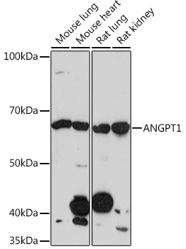 Western blot analysis of various lysates using ANGPT1 Rabbit mAb (TA425839) at 1:1000 dilution.<br/>Secondary antibody: HRP-conjugated Goat anti-Rabbit IgG (H+L) at 1:10000 dilution.<br/>Lysates/proteins: 25μg per lane.<br/>Blocking buffer: 3% nonfat dry milk in TBST.<br/>Detection: ECL Enhanced Kit .<br/>Exposure time: 3min.