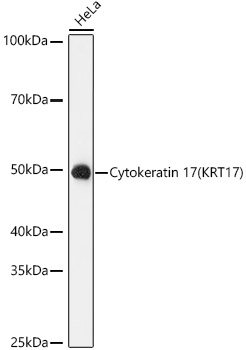 Western blot analysis of lysates from HeLa cells, using Cytokeratin 17 (KRT17) Rabbit mAb (TA425856) at 1:1000 dilution.<br/>Secondary antibody: HRP-conjugated Goat anti-Rabbit IgG (H+L) at 1:10000 dilution.<br/>Lysates/proteins: 25μg per lane.<br/>Blocking buffer: 3% nonfat dry milk in TBST.<br/>Detection: ECL Basic Kit .<br/>Exposure time: 90s.