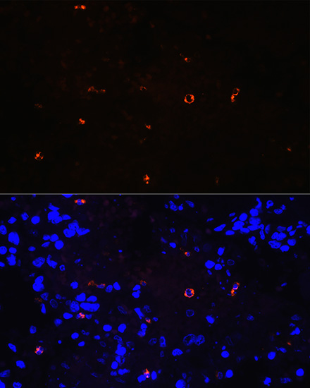 Confocal imaging of paraffin-embedded Human spleen  tissue using Lysozyme (LYZ) Rabbit mAb (TA425860,dilution 1:200)  followed by a further incubation with Cy3 Goat Anti-Rabbit IgG (H+L) (AS007,dilution 1:500)(Red).DAPI was used for nuclear staining (Blue). Objective: 40x. Perform high pressure antigen retrieval with 0.01 M citRate buffer (pH 6.0) prior to IF staining.